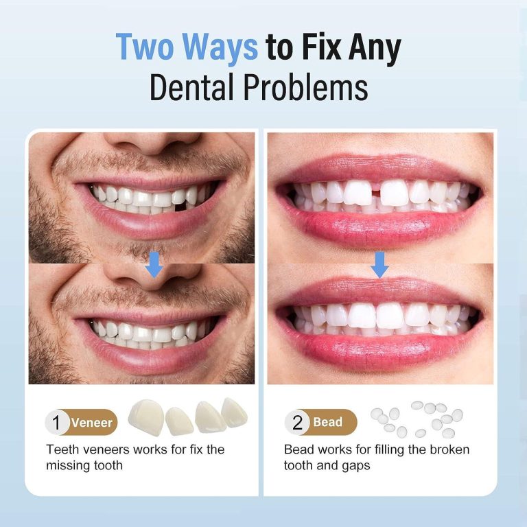 False Teeth for One Missing Tooth: Options, Cost & Procedure - Chaztin